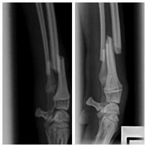 dog forelimb fracture